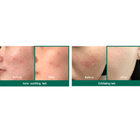 SOMEBYMI AHA-BHA-PHA Miracle Acne Clear Reinigungsschaum 100 ml Bild 2
